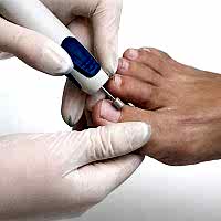 Аппаратный педикюр