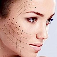 Тредлифтинг (3D - мезонити)